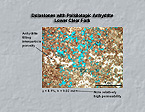 Dolostones with Poikilotopic Anydrite